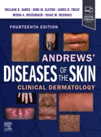 andrews_diseases_of_the_skin.gif