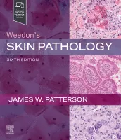 weedons_skin_pathology.gif